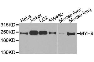 Western blot analysis of extracts of various cell lines, using MYH9 antibody. (Myosin 9 Antikörper  (AA 1711-1960))