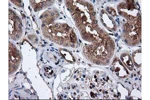 Immunohistochemical staining of paraffin-embedded Human Kidney tissue using anti-CAT mouse monoclonal antibody. (Catalase Antikörper)