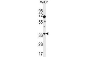 ALDOC Antibody (N-term) western blot analysis in WiDr cell line lysates (35 µg/lane).