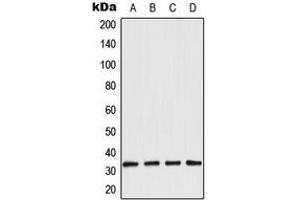 Western blot analysis of Aquaporin 3 expression in LOVO (A), A431 (B), NIH3T3 (C), rat kidney (D) whole cell lysates. (AQP3 Antikörper  (Center))