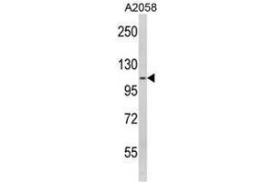 Western blot analysis of SPINK5 Antibody (N-term) in A2058 cell line lysates (35ug/lane). (SPINK5 Antikörper  (N-Term))