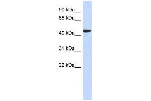 Western Blotting (WB) image for anti-Sphingomyelin Synthase 2 (SGMS2) antibody (ABIN2459623) (Sphingomyelin Synthase 2 Antikörper)