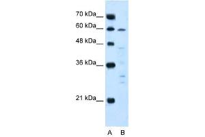 IL10R Alpha antibody used at 5 ug/ml to detect target protein.