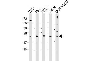 All lanes : Anti- CTLA4 Antibody (N-term) at 1:2000 dilution Lane 1: WiDr whole cell lysate Lane 2: Raji whole cell lysate Lane 3: K562 whole cell lysate Lane 4: Jurkat whole cell lysate Lane 5: CCRF-CEM whole cell lysate Lysates/proteins at 20 μg per lane. (CTLA4 Antikörper  (AA 50-78))