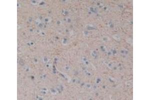 Detection of SP in Human Brain Tissue using Polyclonal Antibody to Substance P (SP) (Substance P Antikörper)