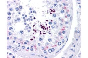 Immunohistochemistry (IHC) image for anti-Cyclin D1 (CCND1) (N-Term) antibody (ABIN2777893) (Cyclin D1 Antikörper  (N-Term))