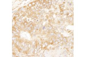 anti-Ribosomal Protein L7 (RPL7) (C-Term) antibody