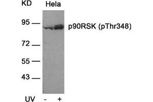 Western blot analysis of extracts from Hela cells untreated or treated with UV using p90RSK(Phospho-Thr348) Antibody. (RPS6KA1 Antikörper  (pThr348))