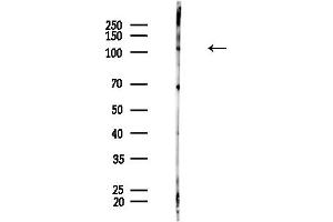 Western blot analysis of lysates from Mouse brain, using CYLD Antibody at 1/1000 dilution.