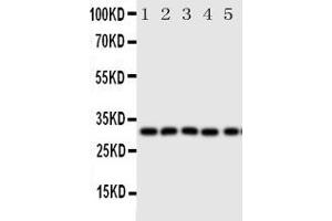 Anti-Aquaporin 9 antibody, Western blottingAll lanes: Anti Aquaporin 9  at 0. (AQP9 Antikörper  (C-Term))