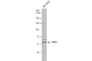 WB Image PAK1 antibody detects PAK1 protein by western blot analysis.