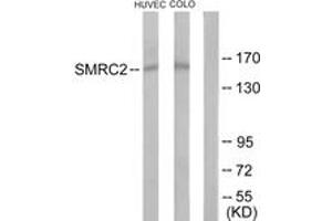 Western blot analysis of extracts from HuvEc/COLO205 cells, using SMRC2 Antibody. (SMARCC2 Antikörper  (AA 361-410))