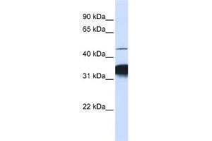 WB Suggested Anti-RXRA Antibody Titration: 0. (Retinoid X Receptor alpha Antikörper  (C-Term))