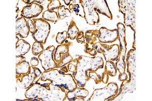 IHC analysis of TANK using anti-TANK antibody (ABIN6719508). (TANK Antikörper)