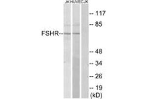 Western blot analysis of extracts from Jurkat/HuvEc cells, using FSHR Antibody. (FSHR Antikörper  (AA 211-260))