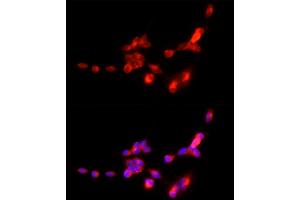 Immunofluorescence (IF) image for anti-Solute Carrier Family 17 (Vesicular Glutamate Transporter), Member 7 (SLC17A7) (AA 461-560) antibody (ABIN6147863)