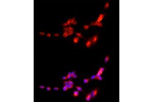 Immunofluorescence analysis of SH-SY5Y cells using SLC17 Rabbit pAb (ABIN6127303, ABIN6147863, ABIN6147864 and ABIN6216671) at dilution of 1:250 (40x lens). (SLC17A7 Antikörper  (AA 461-560))