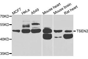 Western blot analysis of extracts of various cell lines, using TSEN2 antibody. (TSEN2 Antikörper)