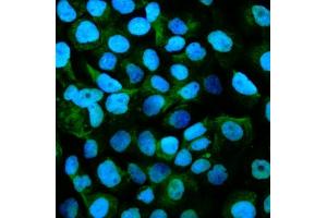 IF analysis of Gpnmb using anti-Gpnmb antibody (ABIN7600217). (Osteoactivin Antikörper  (AA 164-564))