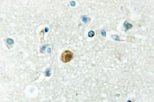 Image no. 1 for anti-Interferon Regulatory Factor 3 (IRF3) antibody (ABIN317879) (IRF3 Antikörper)