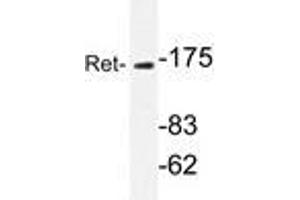 Western blot analyzes of Ret antibody in extracts from K562 cells. (Ret Proto-Oncogene Antikörper)
