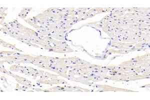 Detection of SLC in Rat Cardiac Muscle Tissue using Polyclonal Antibody to Secondary Lymphoid Tissue Chemokine (SLC) (CCL21 Antikörper  (AA 5-132))
