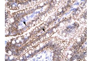 Claudin 8 antibody was used for immunohistochemistry at a concentration of 4-8 ug/ml to stain Epithelial cells of intestinal villus (arrows) in Human Intestine.