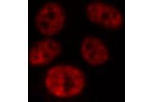 Immunofluorescence (fixed cells) (IF/ICC) image for anti-Myc Proto-Oncogene protein (MYC) (N-Term) antibody (ABIN6263454)