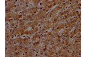 IHC image of ABIN7127592 diluted at 1:100 and staining in paraffin-embedded human liver tissue performed on a Leica BondTM system. (Rekombinanter KLKB1 Antikörper)