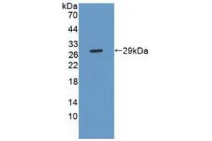 Figure. (Phospholipase C gamma 2 Antikörper  (AA 930-1152))