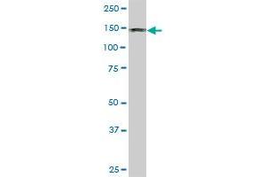 DDEF1 monoclonal antibody (M01), clone 2G7.