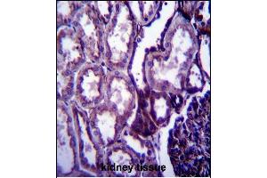 Immunohistochemistry (Paraffin-embedded Sections) (IHC (p)) image for anti-Insulin-Like Growth Factor 1 (IGF1) (AA 115-144), (C-Term) antibody (ABIN658020)
