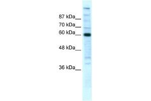 WB Suggested Anti-POLR2B Antibody Titration:  5ug/ml  Positive Control:  HepG2 cell lysate (POLR2B Antikörper  (N-Term))