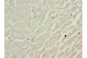 Immunohistochemistry of paraffin-embedded human heart tissue using ABIN7148048 at dilution of 1:100 (Cofilin 2 Antikörper  (AA 1-166))