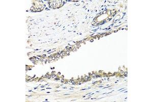 Immunohistochemistry of paraffin-embedded human prostate using BRCA1 antibody. (BRCA1 Antikörper  (AA 120-220))