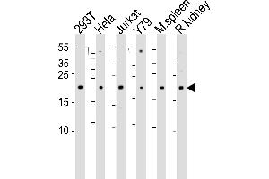 Western blot analysis of lysates from 293T, Hela, Jurkat, Y79 cell line , mouse spleen and rat kidney tissue lysate(from left to right), using DHFR Antibody (N-term) (ABIN6242878 and ABIN6577408). (Dihydrofolate Reductase Antikörper  (N-Term))