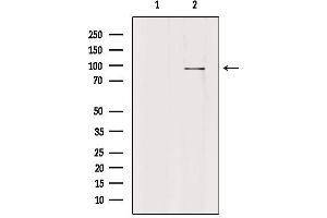 Western blot analysis of extracts from HepG2, using PLA2G4F Antibody. (PLA2G4F Antikörper  (C-Term))