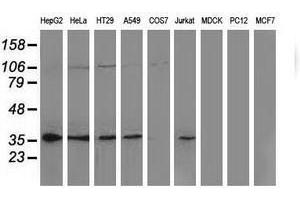 Image no. 2 for anti-Nonhomologous End-Joining Factor 1 (NHEJ1) antibody (ABIN1499732) (NHEJ1 Antikörper)