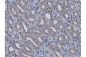 DAB staining on IHC-P; Samples: Rat Kidney Tissue (QARS Antikörper  (AA 2-206))