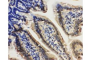 Immunohistochemistry (IHC) image for anti-Lamin A/C (LMNA) (AA 455-469) antibody (ABIN3031585)