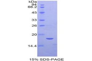 SDS-PAGE analysis of Mouse Semaphorin 3A Protein.