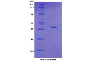 SDS-PAGE (SDS) image for Topoisomerase (DNA) II beta 180kDa (TOP2B) (AA 446-655) protein (His tag) (ABIN2127022)