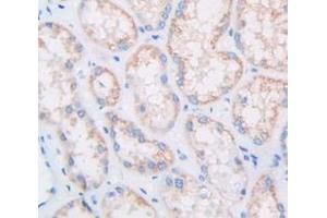 Figure. (Multimerin 1 Antikörper  (AA 807-1053))