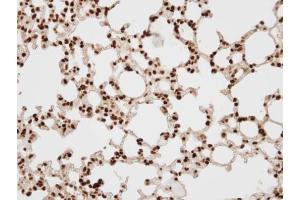 Immunohistochemistry (IHC) image for anti-SWI/SNF Related, Matrix Associated, Actin Dependent Regulator of Chromatin, Subfamily E, Member 1 (SMARCE1) (C-Term) antibody (ABIN2856338)