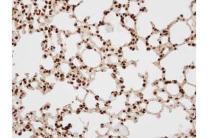 IHC-P Image Immunohistochemical analysis of paraffin-embedded human lung, using BAF57, antibody at 1:100 dilution. (SMARCE1 Antikörper  (C-Term))