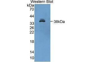 Western Blotting (WB) image for anti-Interferon Regulatory Factor 6 (IRF6) (AA 150-445) antibody (ABIN1859476)