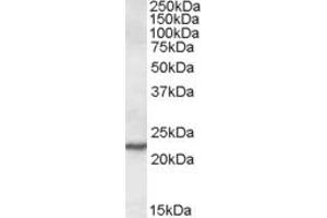 ABIN308431 (0. (SAR1A Antikörper  (Internal Region))