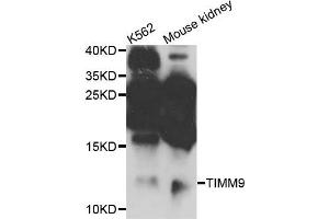 Western blot analysis of extracts of K562 and mouse kidney cells, using TIMM9 antibody. (TIMM9 Antikörper)