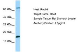 Image no. 1 for anti-Hemoglobin, epsilon 1 (HBe1) (N-Term) antibody (ABIN6749928) (Hemoglobin, epsilon 1 (HBe1) (N-Term) Antikörper)