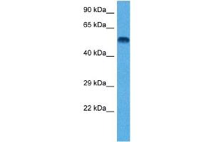 Host:  Rat  Target Name:  TUBB2A  Sample Tissue:  Rat Brain  Antibody Dilution:  1ug/ml (TUBB2A Antikörper  (N-Term))